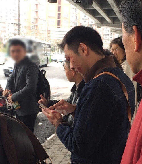 帅哥开兰博基尼跑车撞得稀烂满脸血 高清图片