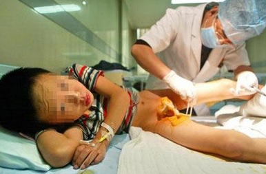 美国母亲撕裂儿子生殖器 用强力胶粘合伤口(图)