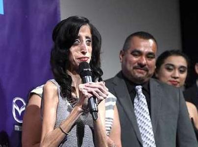 世界上最丑女人:体重只有26公斤 揭全球另类之最【组图】