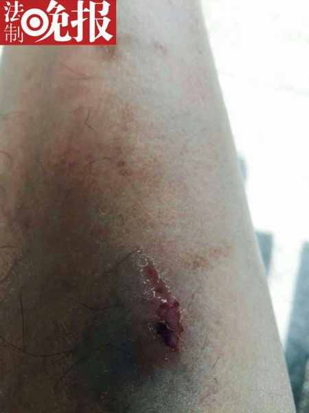 多处破损、流血