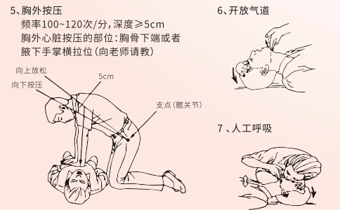 急救技术从心肺复苏学起