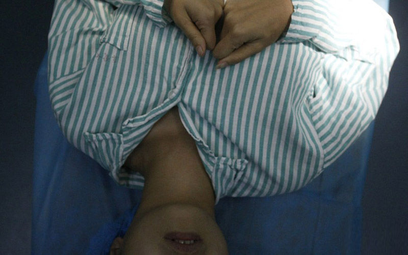 女子双十一隆胸升级F罩杯：成为中国最大人造胸女神