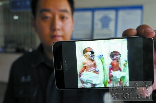 目前，郭先生的双胞胎仍在接受治疗。（记者 陈旭东 摄）