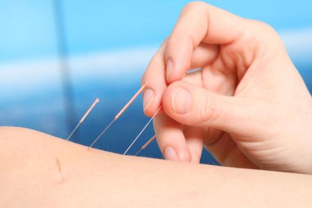 电子针灸恶搞视频,电子针灸恶搞视频大全
