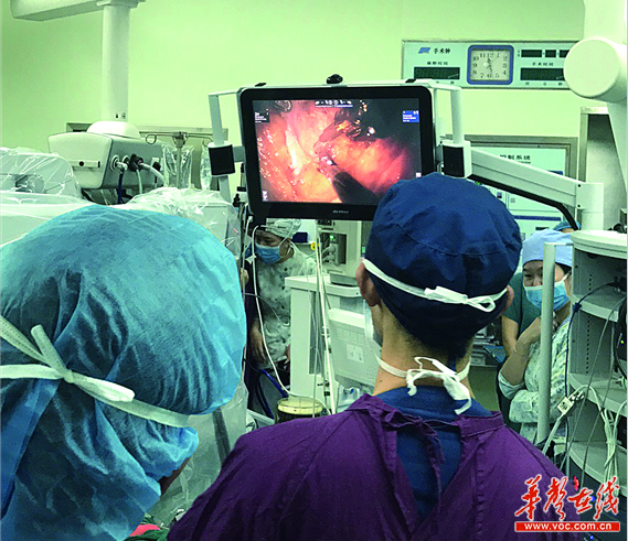 湘雅三医院完成机器人手术833例 你敢来试试吗？