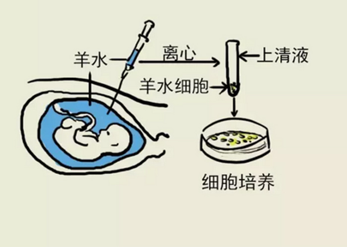 啥是开放性 201708241504491745.jpg