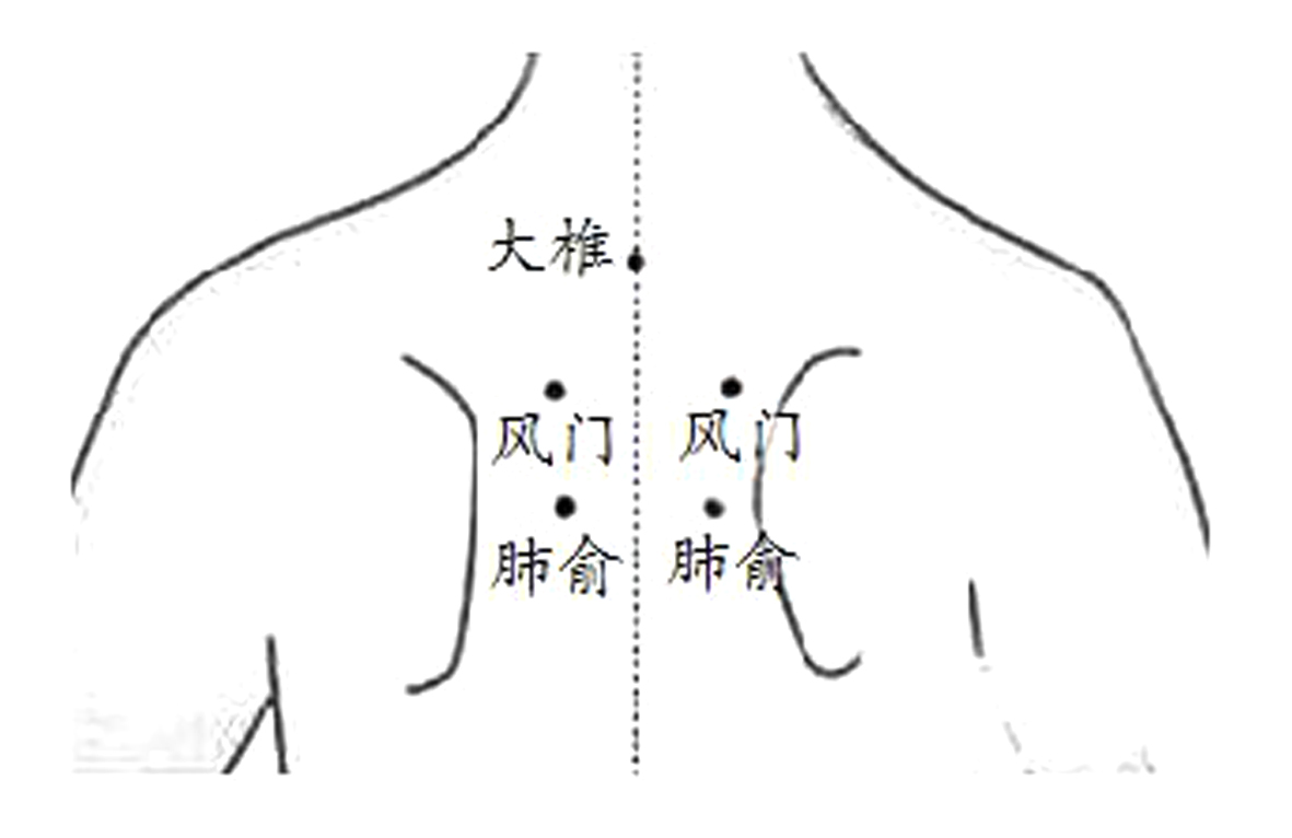 鼻堵的原理_鼻炎知识 找出鼻塞 鼻堵的 真凶 佛山市炏焱健康管理