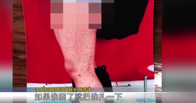 高中女生腿上密密麻麻全是血点 居然是男同桌扎的