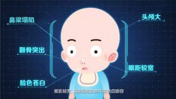 地中海贫血,是一组遗传性溶血性贫血疾病.
