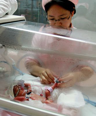 袖珍女婴小美躺在长沙市湘雅医院新生儿科重症监护室恒温箱里接受治疗