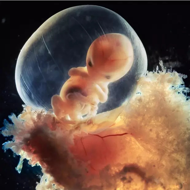 24天后,胎儿的第一批发育的器官之一心脏开始跳动