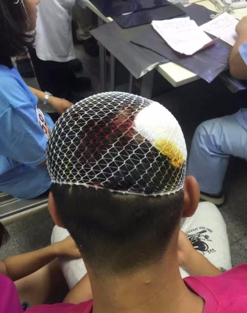 北京狂风致路跑旗门倒塌 跑友被砸头破血流