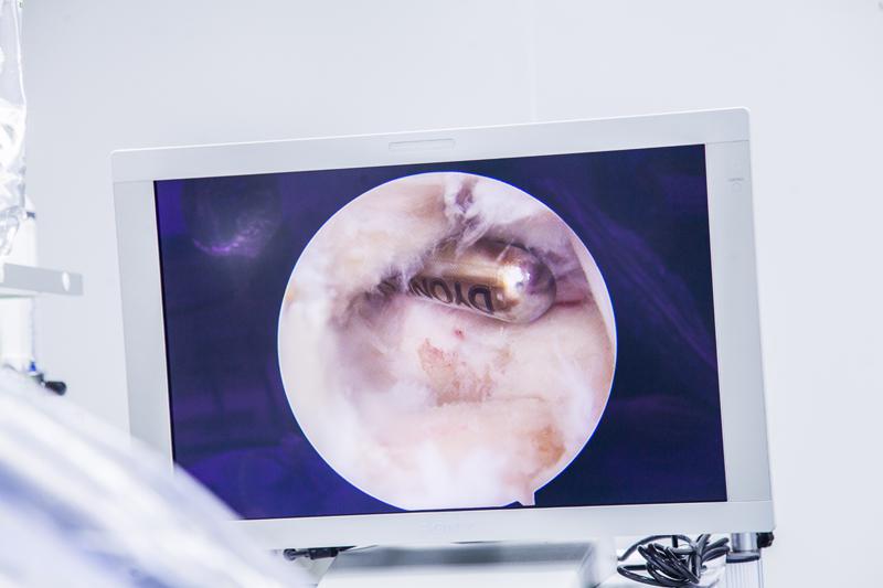 美国进口施乐辉关节镜