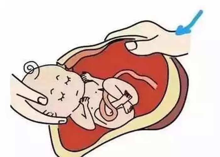 产科姚妈妈告诉你:顺产,没你想的那么可怕