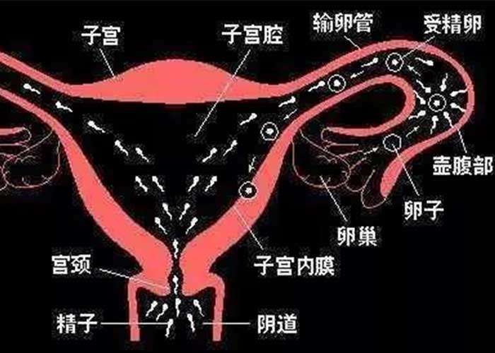 宫角妊娠位置图片