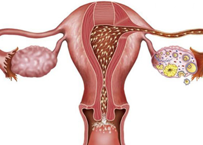 女性怀孕路上的拦路虎浅谈排卵障碍