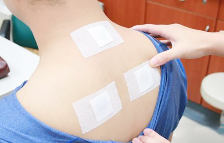 三伏贴热谨防盲目贴敷 临床医生紧急提醒