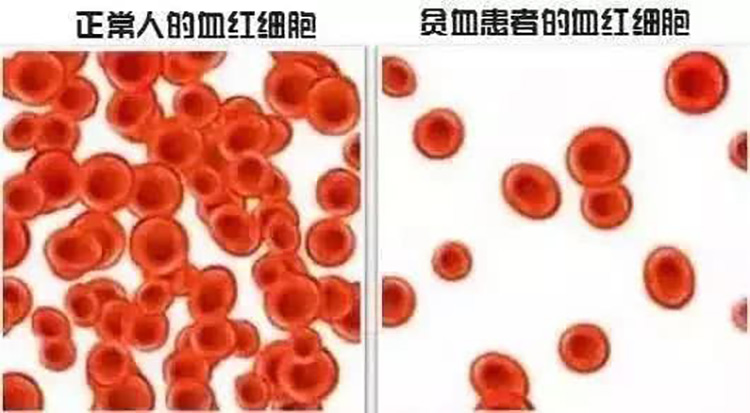红细胞失水图片
