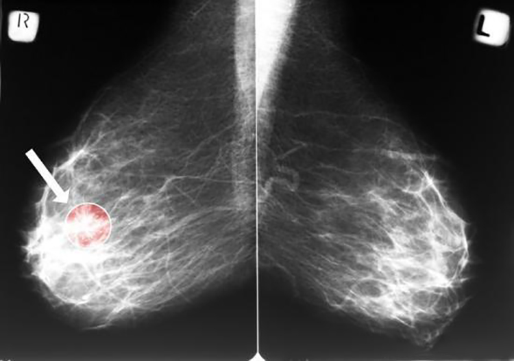 大姨妈刚走,4件事"迫不急待"?你其实是在找病