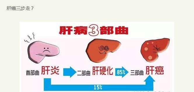 肝癌術後轉移存活數年 預防肝癌專家這樣建議