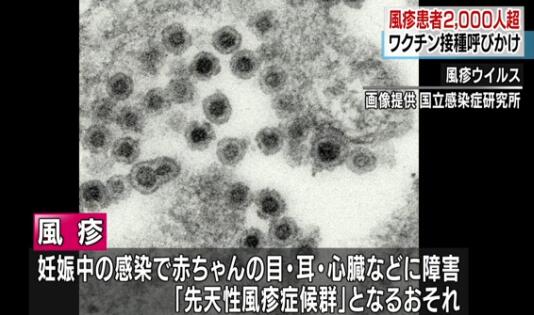 赴日旅游注意：日本爆发风疹，患者已超过2000人