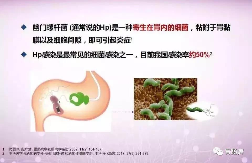图说幽门螺杆菌hp来自消化科主任的权威科普
