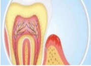 老年人要如何拯救自己萎缩的牙龈？