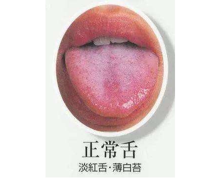 正常人的舌质颜色为淡红,质地较为柔软,活动灵活自如;舌苔为干湿适中