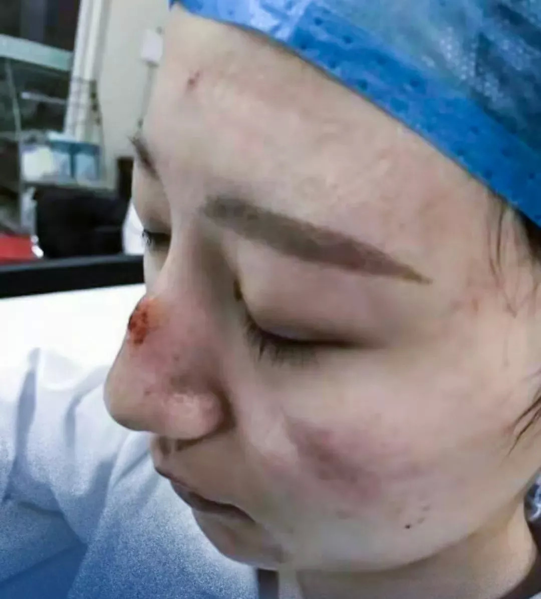 东院区神经内科90后护士单霞在得知疫情严重要日夜奋战时做出的决定