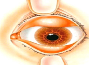 眼结膜——可能感染新冠病毒的途径，防疫期间对此千万不可忽视