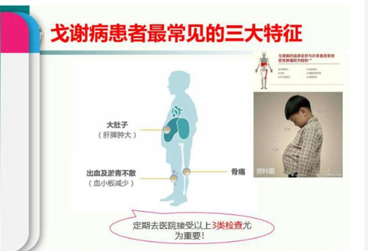 湖南省首次将"超罕见病"纳入医保范围丨关注超级罕见病—戈谢病